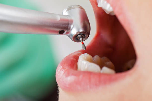 Best Holiday Emergency Dentist in Walkertown, NC